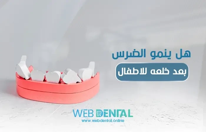 هل ينمو الضرس بعد خلعه للاطفال image