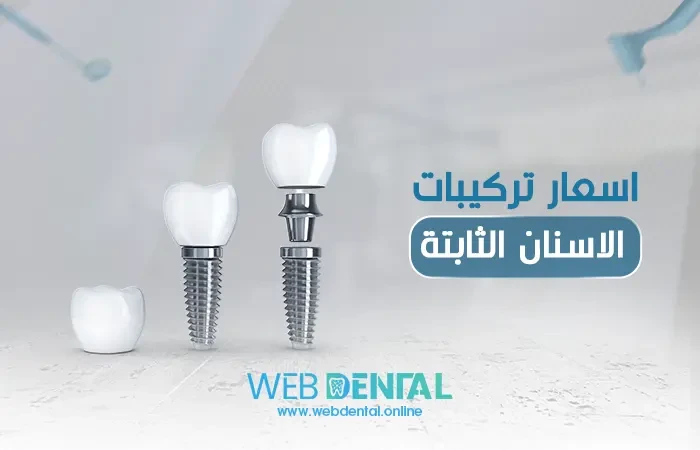 اسعار تركيبات الاسنان الثابتة في مصر image