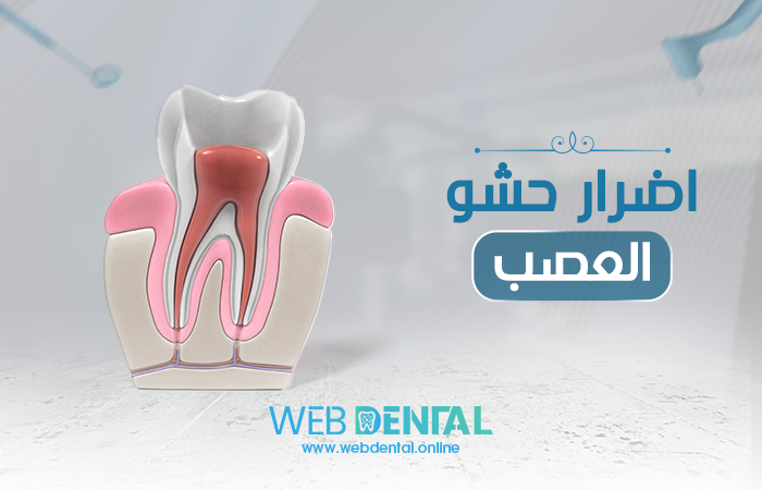 اضرار حشو العصب image