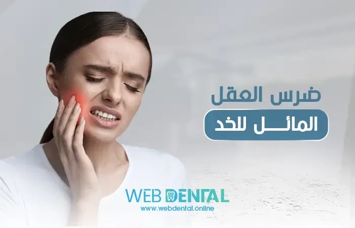 خلع الضرس الملتهب بالخراج ـ هل هو الحل الوحيد؟ image