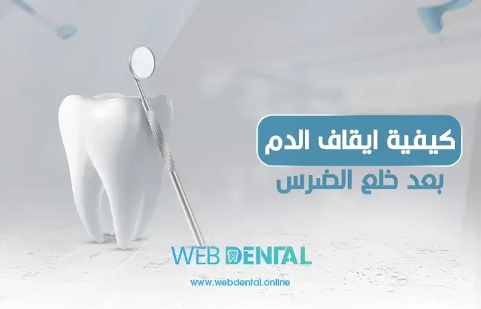 كيفية ايقاف الدم بعد خلع الضرس image