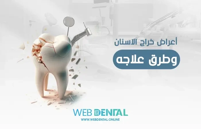 أعراض خراج الاسنان وطرق علاجه image