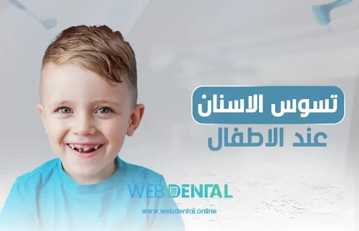 علاج تسوس الاسنان عند الاطفال سنتين image