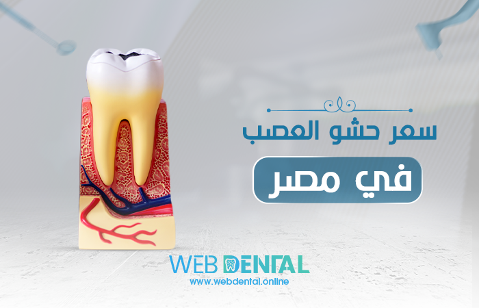 سعر حشو العصب في مصر image