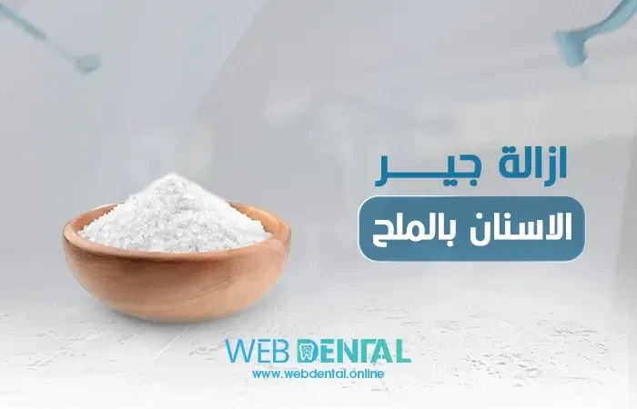 ازالة جير الاسنان بالملح image
