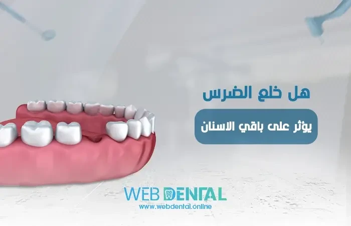 هل خلع الضرس يؤثر على باقي الاسنان؟ اعرف الجواب image